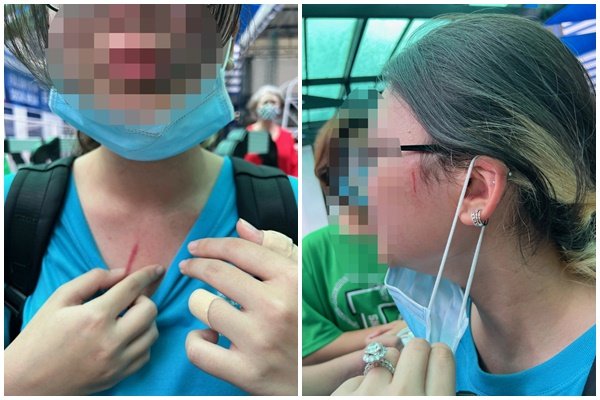 Chị T. cho biết, con gái chị và 3 bạn khác bị cùng 1 nữ sinh hành hung