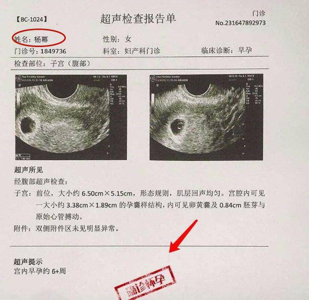 Giấy siêu âm được chứng minh không phải hình ảnh thật.