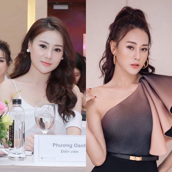 Phương Oanh khi PTTM 20 ngày và sau 2 năm.
