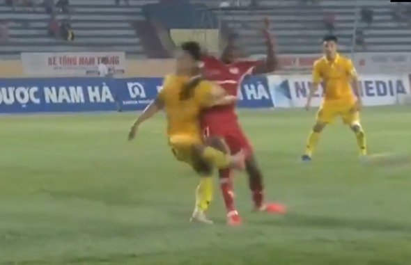 Bruno Cunha có tình huống trả đũa cầu thủ Nam Định.
