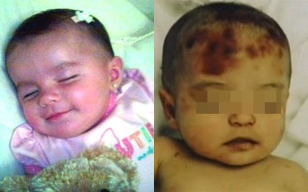 Vụ xâm hại chấn động nước Mỹ: Bé gái mới 5 tháng tuổi bị cha đẻ, cậu ruột lạm dụng, bạo hành, mẹ thờ ơ
