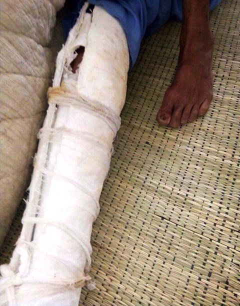 Nghệ An: Phẫn nộ con trai đánh cha gãy xương sườn