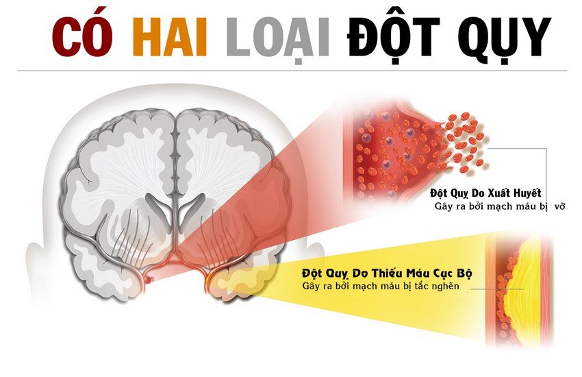 dot-quy-la-gi-va-dot-quy-nguy-hiem-nhu-the-nao