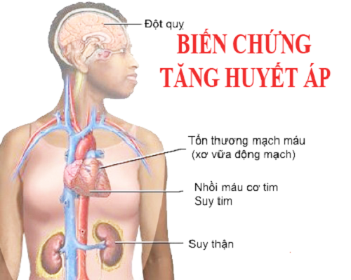 huyet-ap-cao-la-gi-va-huyet-ap-cao-nguy-hiem-nhu-the-nao