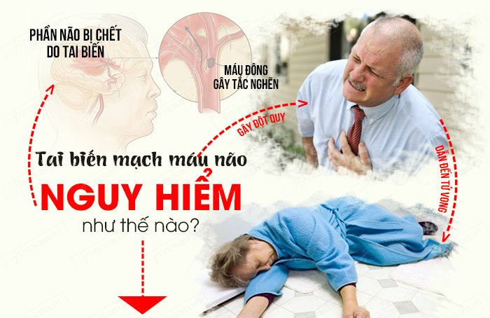 tai-bien-mach-mau-nao-la-gi-va-tai-bien-mach-mau-nao-nguy-hiem-nhu-the-nao