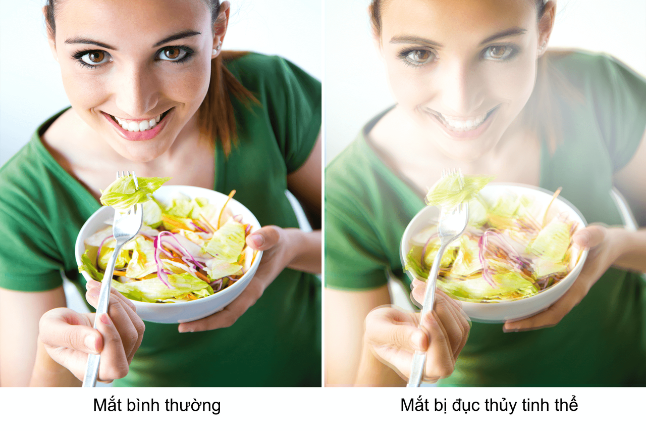 duc-thuy-tinh-the-la-gi-va-duc-thuy-tinh-the-neu-de-lau-de-gay-mu-loa