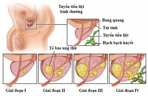 co-the-lam-duoc-nhung-gi-voi-5-ty-usd-thu-duoc-tu-viec-thoai-von-sabeco