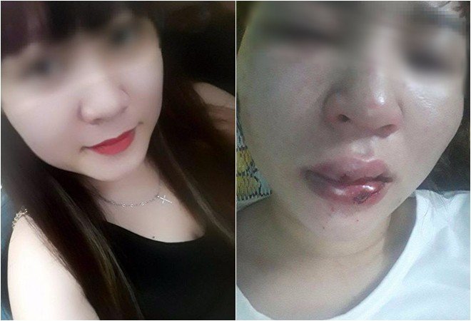 Khi con người lựa chọn giơ tay cứu giúp đồng loại nhưng lại phải trả những cái giá quá đắt