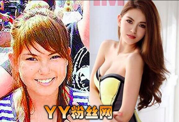 Vợ 9X của Châu Kiệt Luân xinh đẹp nhờ dao kéo