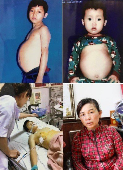 Chồng ngược đãi, vợ một mình gồng gánh chữa bệnh cho 3 con bệnh tật, tai nạn