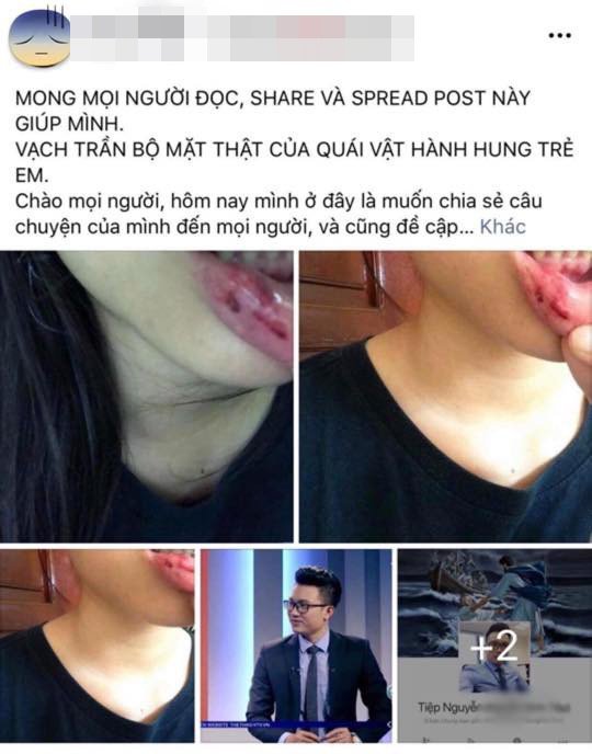 btv-minh-tiep-bi-nem-da-du-doi-be-dung-dang-bi-gia-dinh-khong-che