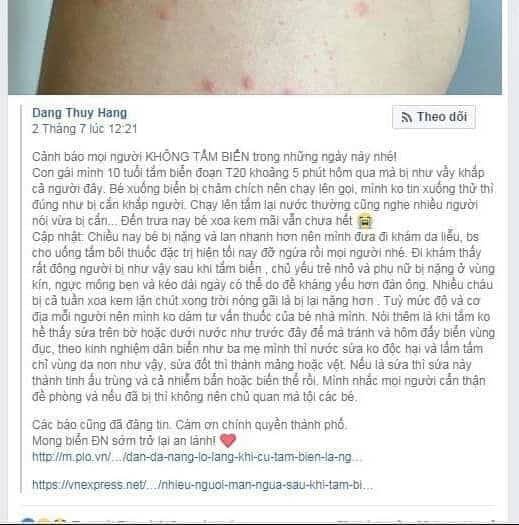 thuc-hu-chuyen-nguoi-dan-va-du-khach-tam-bien-da-nang-bi-noi-man-do