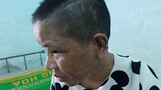 Lời kể rùng rợn của cô gái nghi bị chủ tra tấn dã man