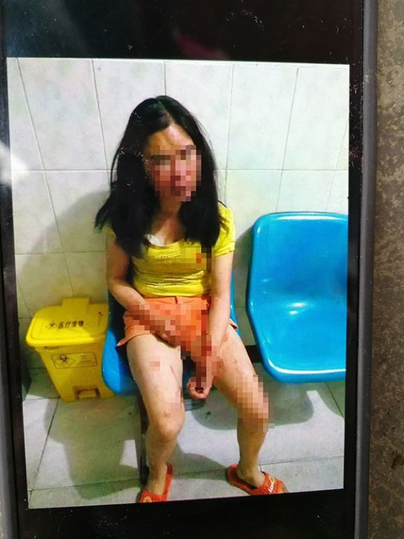 Con dâu đột ngột qua đời, hàng xóm nghi ngờ bố mẹ chồng bạo hành, bắt chồng báo cảnh sát