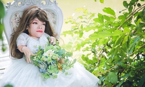Cô gái khéo tay sống trong hình hài Sọ Dừa