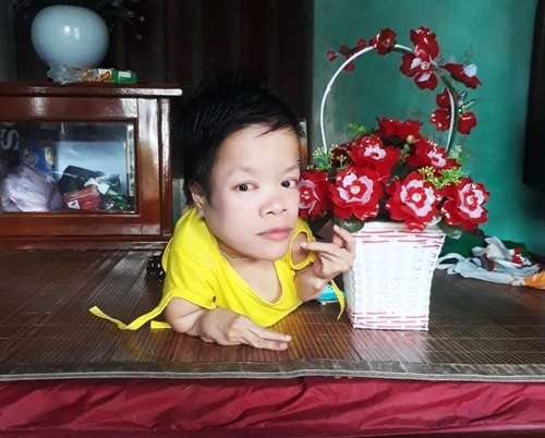 Cô gái khéo tay sống trong hình hài Sọ Dừa