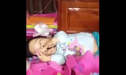 Cô gái khéo tay sống trong hình hài Sọ Dừa