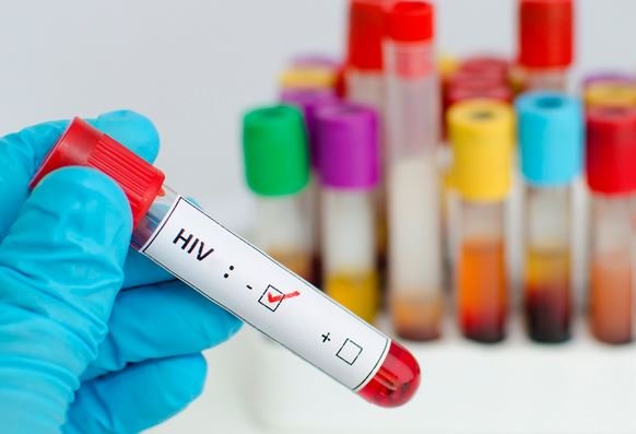 vu-ca-xa-nao-loan-nghi-nhiem-hiv-o-phu-tho-nhung-viec-can-lam-ngay-khi-bi-phoi-nhiem-hiv