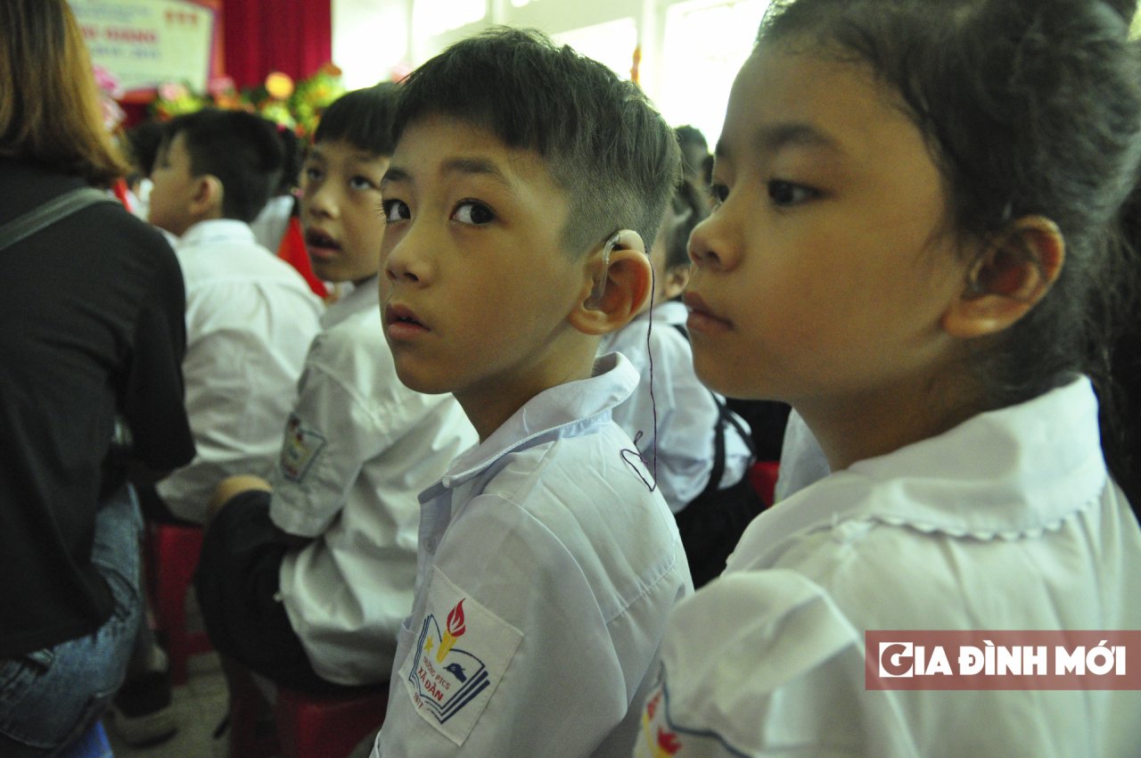  Nhiều em học sinh phải dùng tới sự trợ giúp của thiết bị trợ thính 