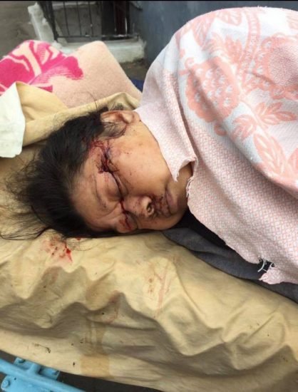 nong: mot phu nu viet o ukraine bi cuop ban dan xuyen qua gan mat hinh anh 2