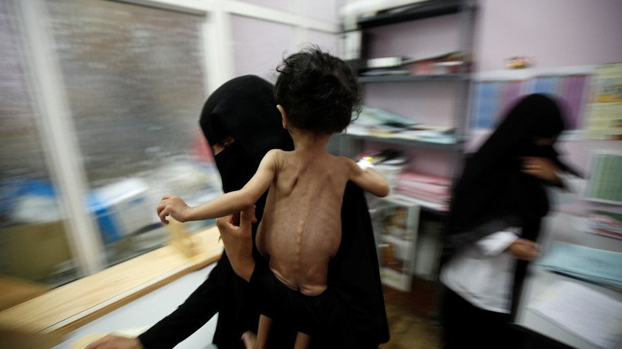 my-keu-goi-arab-saudi-ngung-khong-kich-cac-khu-dong-dan-o-yemen