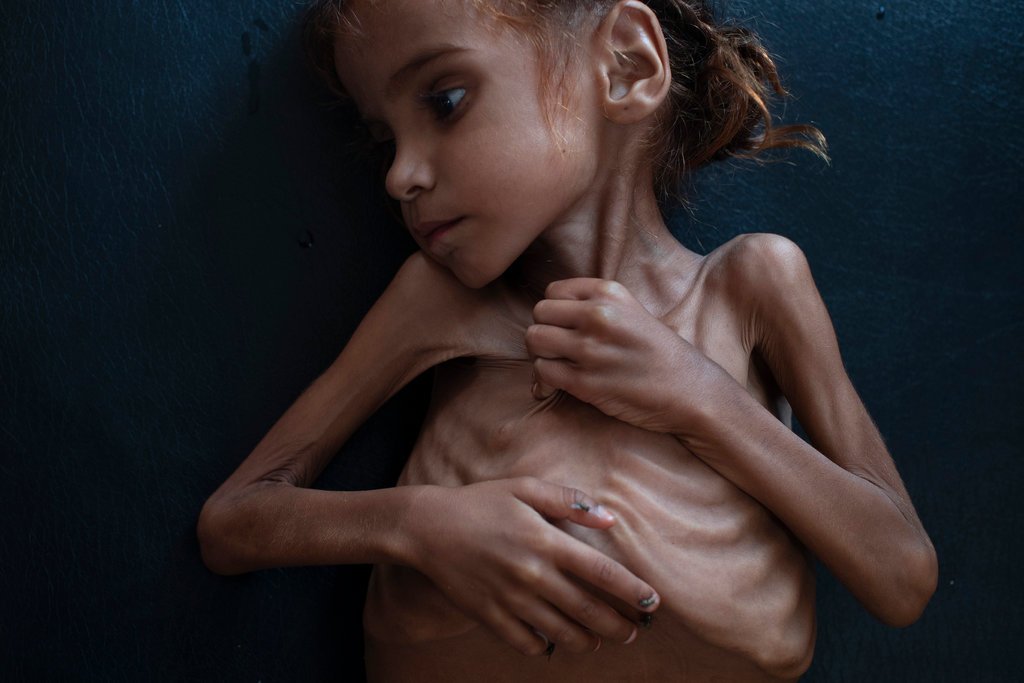 co-be-yemen-khien-ca-the-gioi-thuc-tinh-da-qua-doi