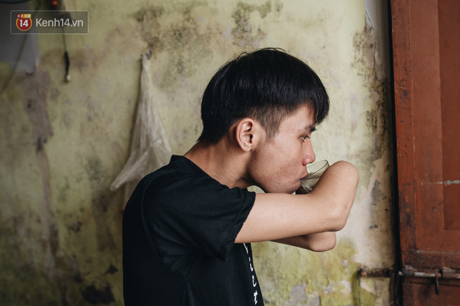 chang-sinh-vien-ha-noi-mat-2-canh-tay-truoc-ngay-thi-dai-hoc-con-song-thi-song-cho-dang-moi-chuyen-roi-se-tot-len