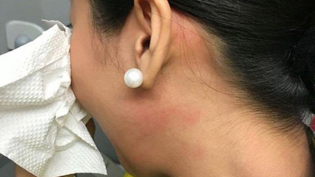 nhung-vu-tiep-vien-nhan-vien-hang-khong-bi-hanh-hung-gay-chan-dong-o-viet-nam
