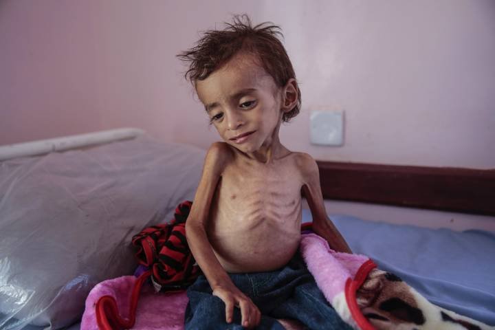 Yemen là quốc gia nào