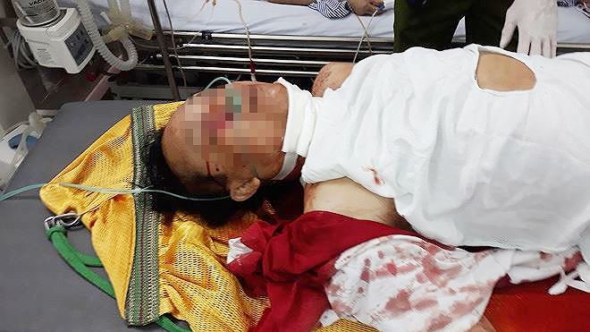 Thảm án 5 người thương vong: Hung thủ có dấu hiệu hoang tưởng?