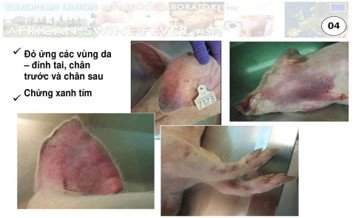 dich-ta-lon-chau-phi-la-gi-trieu-chung-lon-mac-dich-ta-lon-chau-phi