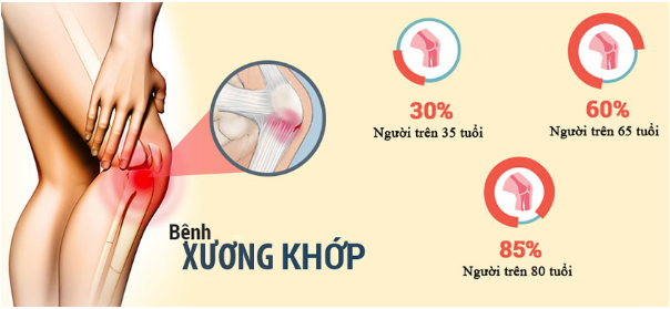 khop-khang-tho-khac-phuc-benh-xuong-khop-chi-bang-thao-duoc-tu-nhien