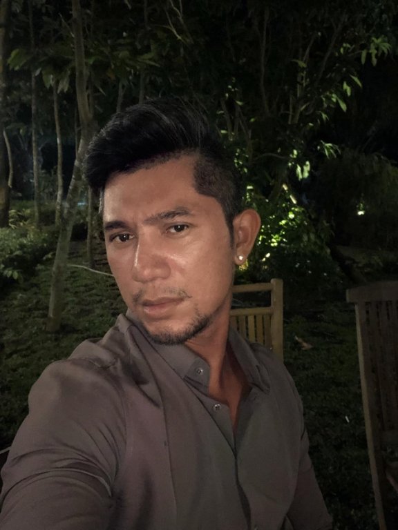 luong-bang-quang-bi-che-xau-o-doi-thuong-sau-cong-khai-phau-thuat-tham-my