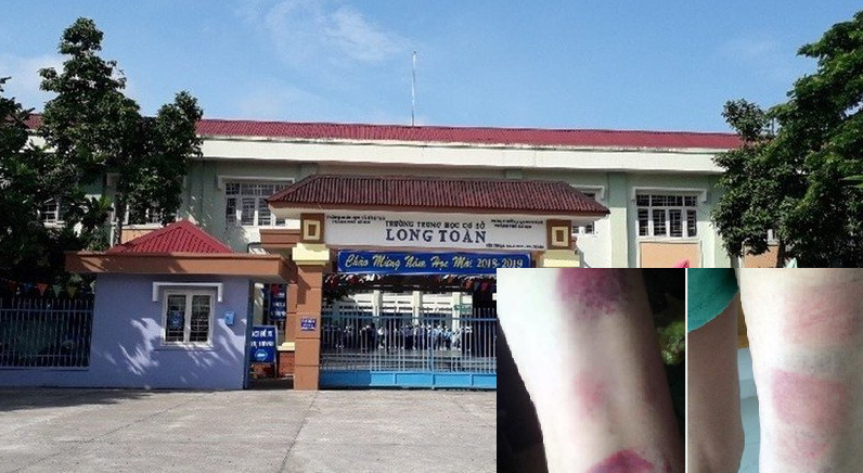 tin-tuc-an-ninh-hinh-su-moi-nhat-ngay-34-kha-banh-bi-bat-ve-toi-danh-bac-be-gai-bi-sam-so-thang-may-chung-cu