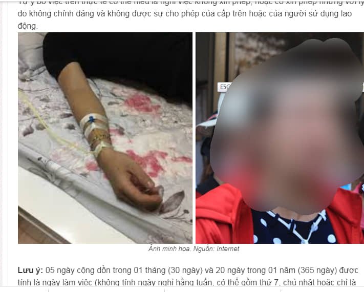 Một hình ảnh của cô gái mà webtretho đã lấy để minh họa cho bài viết của mình (PV đã che mặt nhân vật).