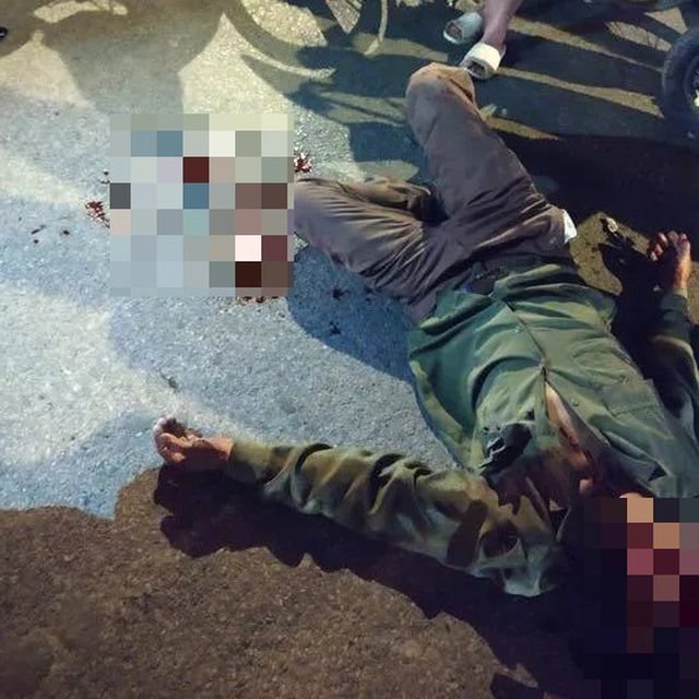Người đàn ông bị thương sau vụ tai nạn.