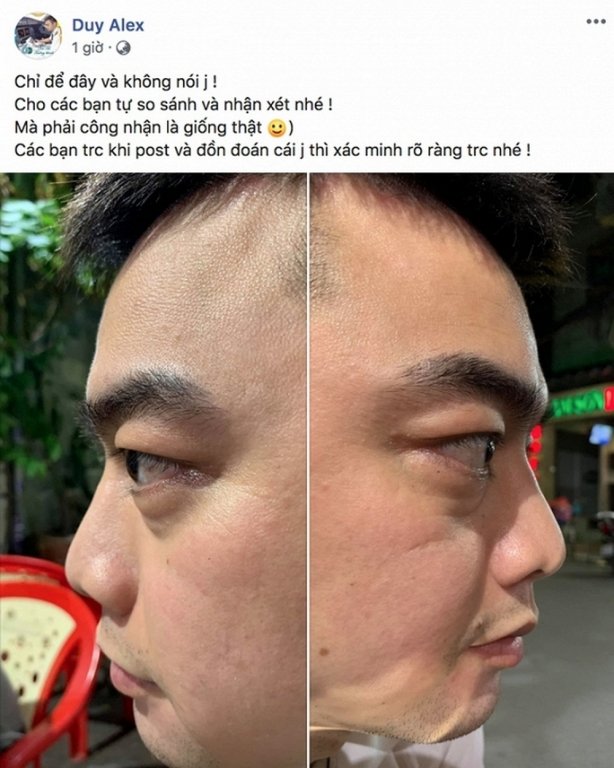 clip-nong-ha-duy-4-ngoisao.vn-w650-h813