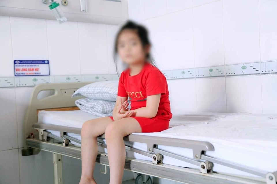 benh-vien-tinh-can-thiep-thanh-cong-cho-benh-nhi-bi-thong-lien-that-bam-sinh