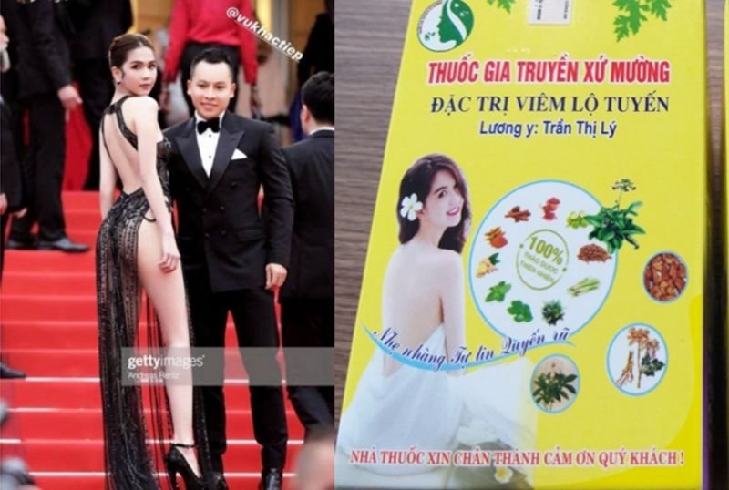 ngoc-trinh-ho-henh-tham-do-cannes-bong-xuat-hien-thuoc-phu-khoa-xu-muong