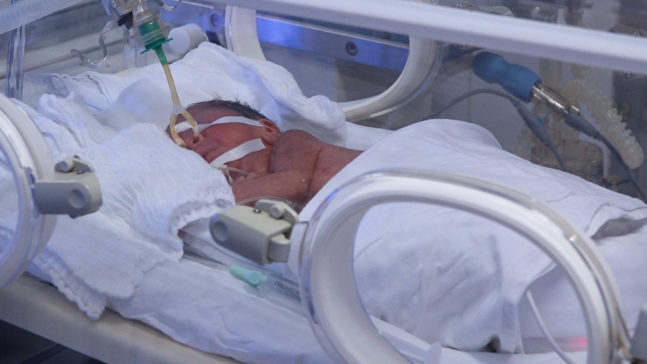 Bé Bình An được các bác sĩ đánh giá có dấu hiệu sinh tồn tốt và có thể ra viện trong 7-8 tuần tới.