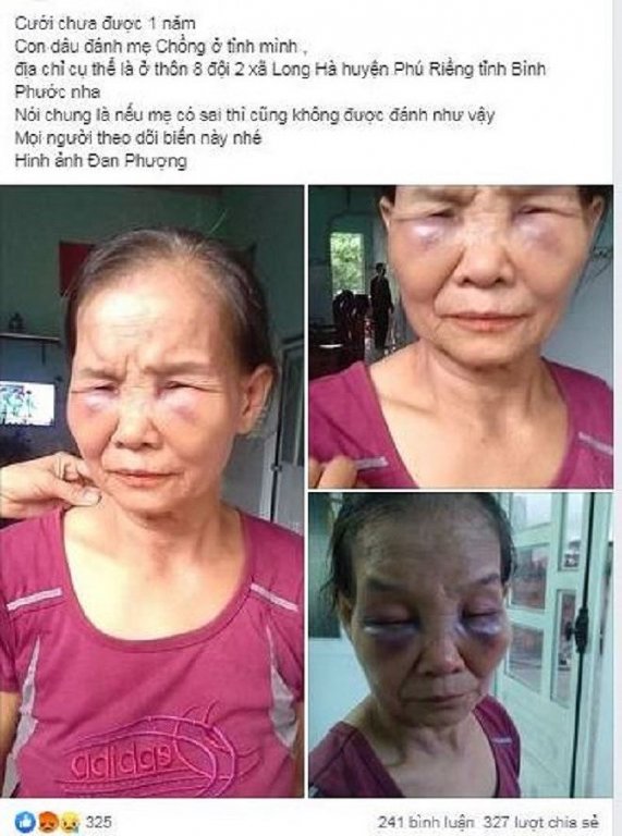 Hình ảnh bà Tạo sau khi bị con dâu đánh được chia sẻ lên mạng xã hội