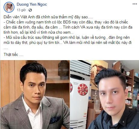 hau-ly-hon-viet-anh-gay-hoang-mang-voi-dien-mao-khac-la-do-phau-thuat-tham-my