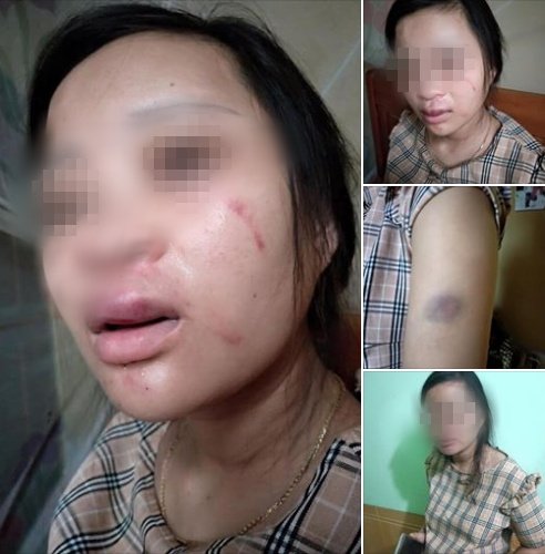 vo-mang-thai-8-thang-bi-chong-danh-bam-dap-vi-len-mua-doi-giay-135-nghin