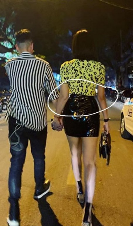 luu-de-li-photoshop-qua-da-den-di-dang-ca-canh-tay-anti-fan-lap-tuc-mia-mai-tay-bi-di-tat-do-giat-chong-nguoi-khac