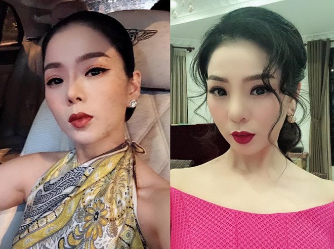 truoc-viet-anh-nhieu-sao-viet-tung-phau-thuat-hong