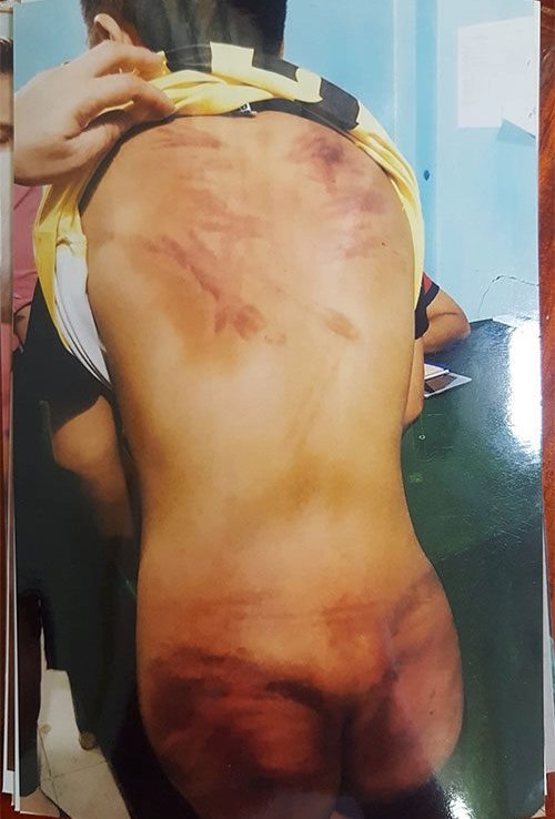 that-long-nghe-loi-ke-cua-cau-be-11-tuoi-bi-thay-tu-danh-dap-ep-xem-phim-doi-truy-o-binh-thuan