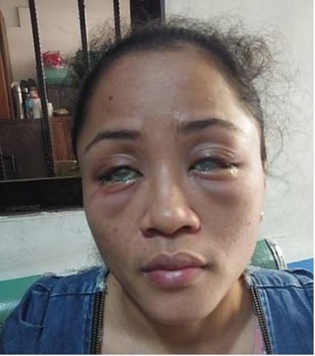 phat-hien-ban-trai-co-nguoi-tinh-dong-tinh-ben-ngoai-co-gai-chua-het-dau-long-con-bi-danh-ghen-nguoc-doi-mat-nguy-co-mu-ca-hai-mat