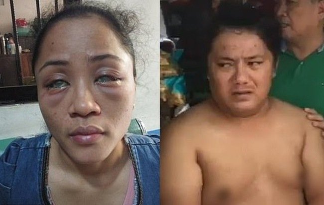 phat-hien-ban-trai-co-nguoi-tinh-dong-tinh-ben-ngoai-co-gai-chua-het-dau-long-con-bi-danh-ghen-nguoc-doi-mat-nguy-co-mu-ca-hai-mat