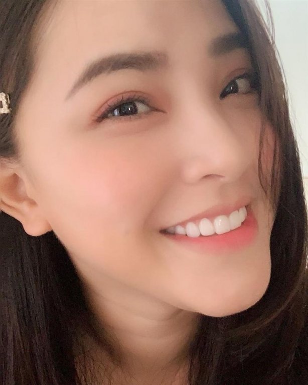 Vướng tin đồn độn cằm, Hải Băng lên tiếng: