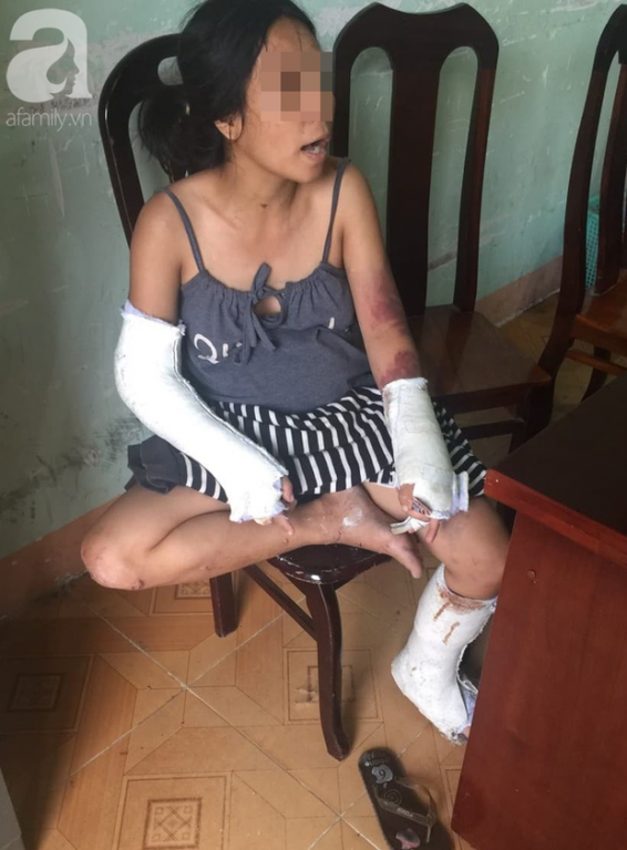 Người phụ nữ với những vết thương sau những trận đòn roi, bạo hành. (Ảnh: Afamily).